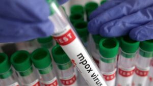 Local Clinic To Dermatology OPD: How Mpox Was Confirmed In Kerala’s 38-Year-Old Patient